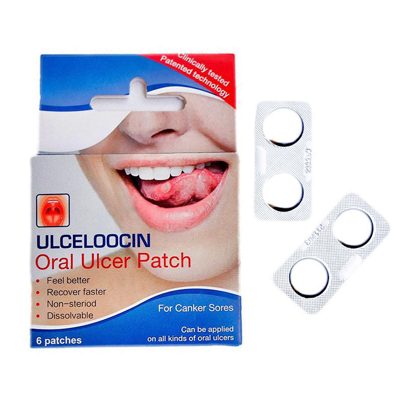 Ulceloocin Oral Ulcer Patch 6's